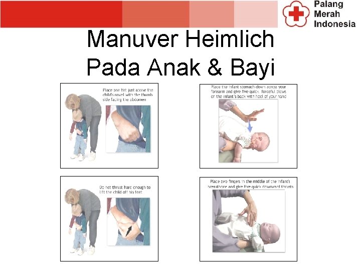 Manuver Heimlich Pada Anak & Bayi 