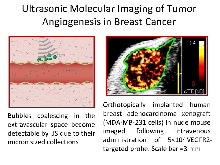 Ultrasound Imaging Contrast Agents and Therapy BIOE 477598