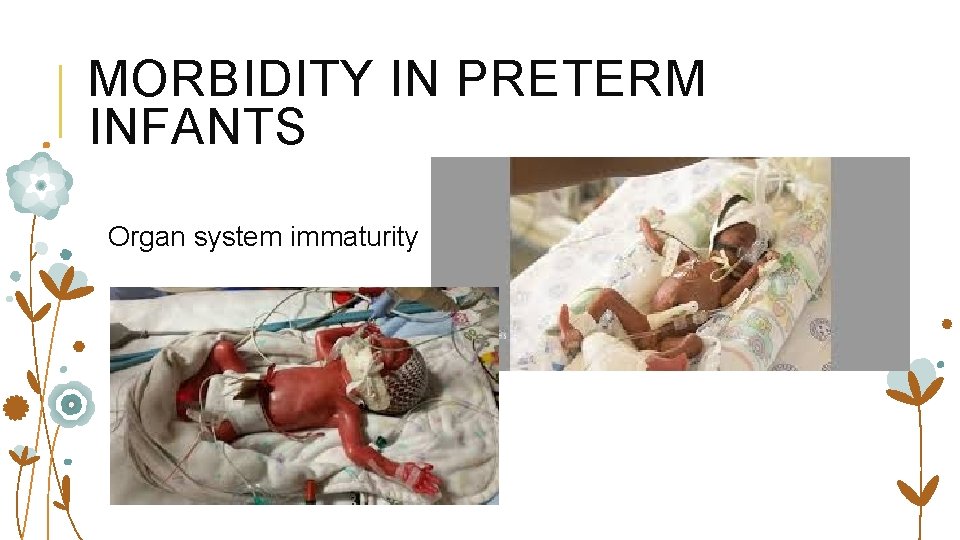 MORBIDITY IN PRETERM INFANTS Organ system immaturity 