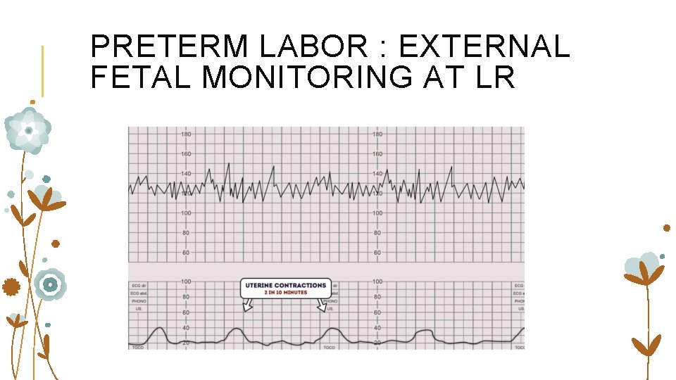 PRETERM LABOR : EXTERNAL FETAL MONITORING AT LR 