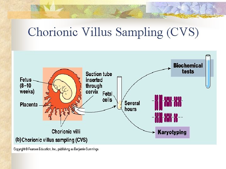 Chorionic Villus Sampling (CVS) 