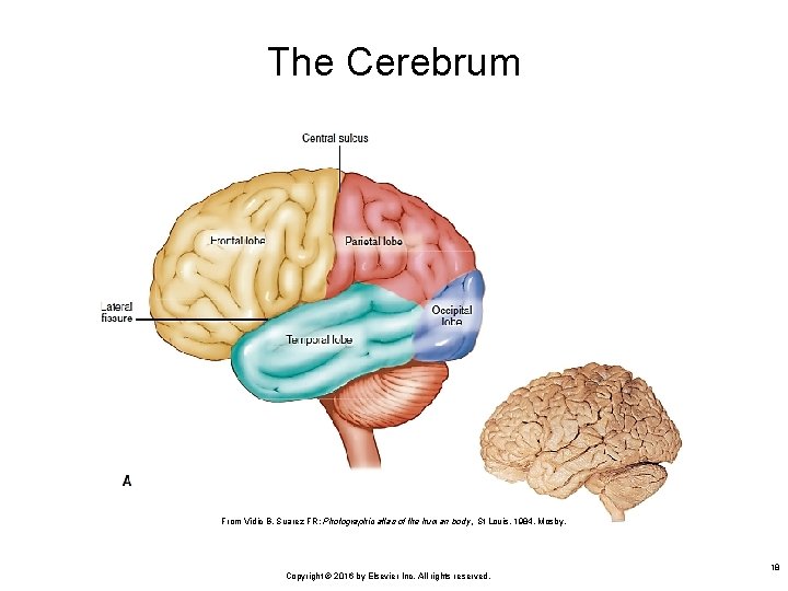 The Cerebrum From Vidic B, Suarez FR: Photographic atlas of the human body, St