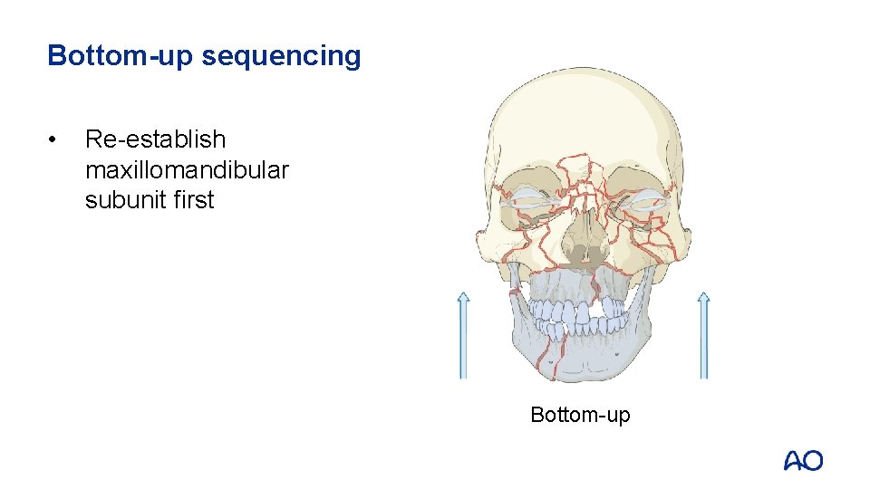 Bottom-up sequencing • Re-establish maxillomandibular subunit first Bottom-up 