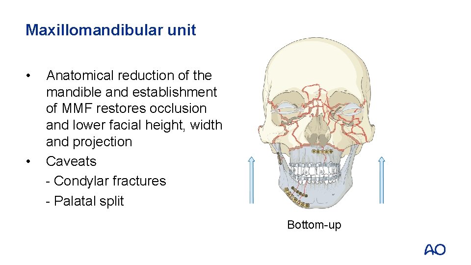 Maxillomandibular unit • • Anatomical reduction of the mandible and establishment of MMF restores