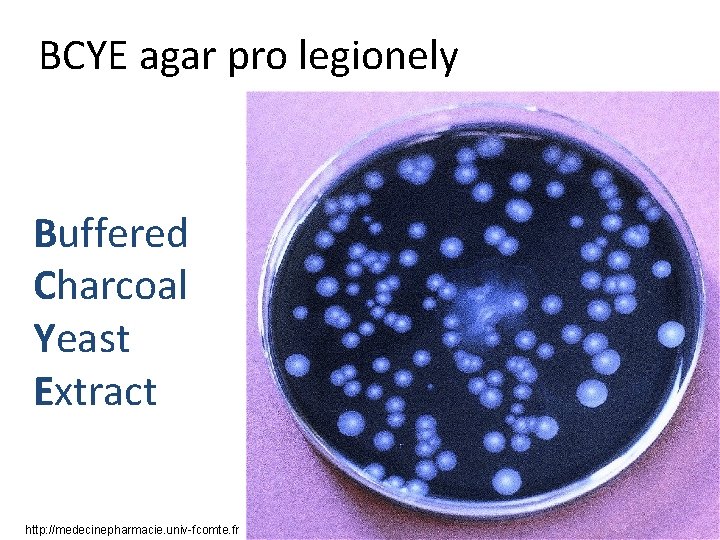 BCYE agar pro legionely Buffered Charcoal Yeast Extract http: //medecinepharmacie. univ-fcomte. fr 