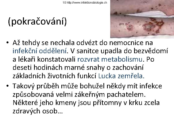 10 http: //www. infektionsbiologie. ch (pokračování) • Až tehdy se nechala odvézt do nemocnice