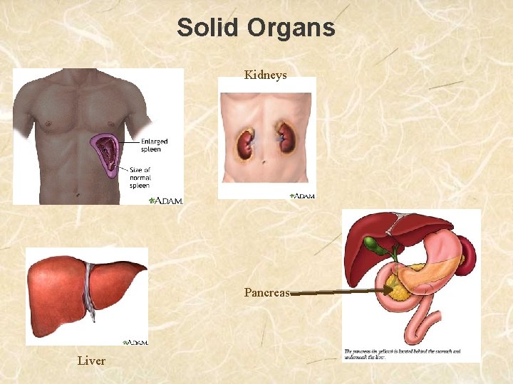 Solid Organs Kidneys Pancreas Liver 