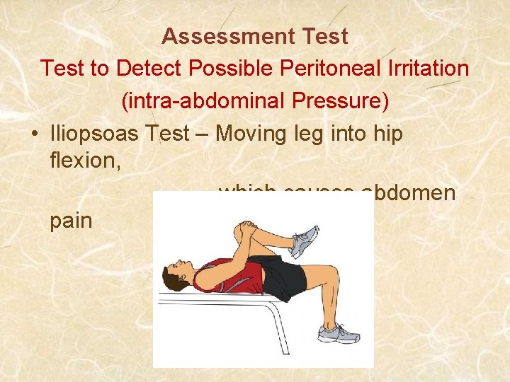 Assessment Test to Detect Possible Peritoneal Irritation (intra-abdominal Pressure) • Iliopsoas Test – Moving