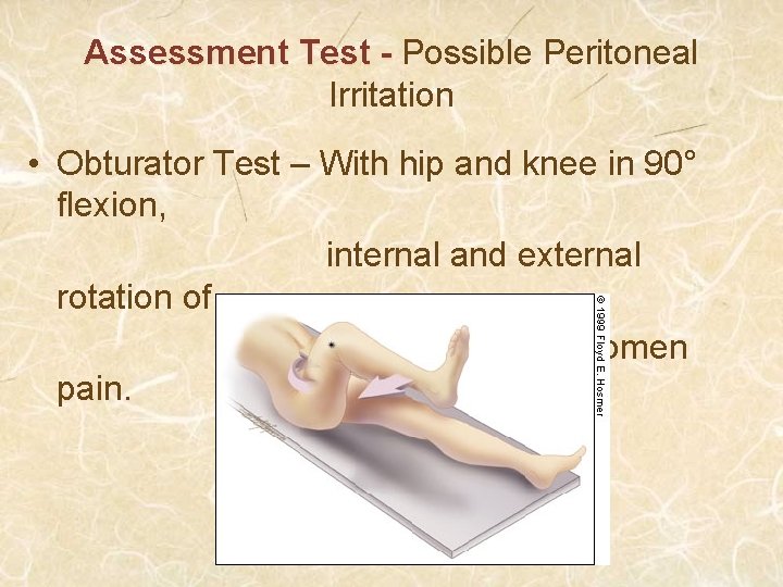 Assessment Test - Possible Peritoneal Irritation • Obturator Test – With hip and knee