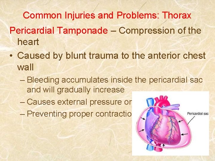 Common Injuries and Problems: Thorax Pericardial Tamponade – Compression of the heart • Caused