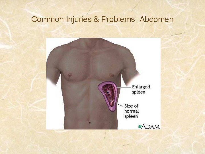 Common Injuries & Problems: Abdomen 