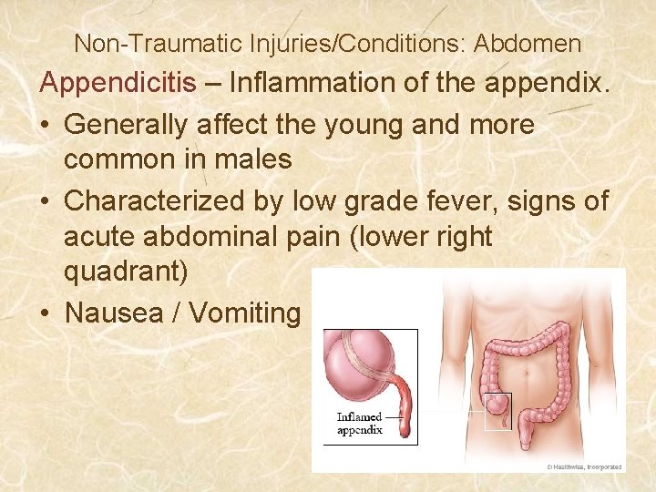 Non-Traumatic Injuries/Conditions: Abdomen Appendicitis – Inflammation of the appendix. • Generally affect the young