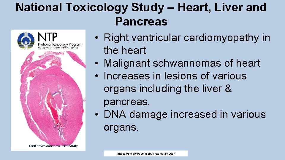 National Toxicology Study – Heart, Liver and Pancreas • Right ventricular cardiomyopathy in the