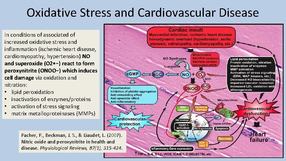 Oxidative Stress and Cardiovascular Disease In conditions of associated of increased oxidative stress and