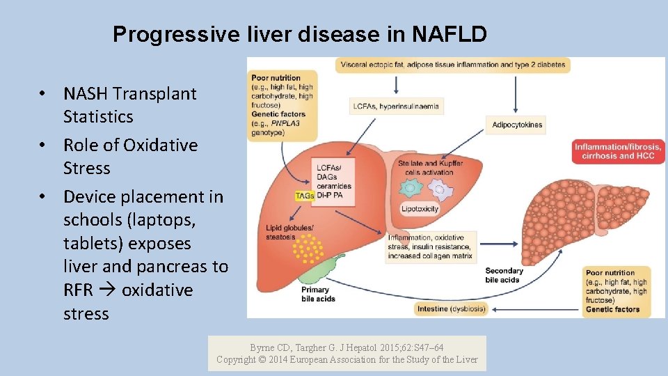 Progressive liver disease in NAFLD • NASH Transplant Statistics • Role of Oxidative Stress