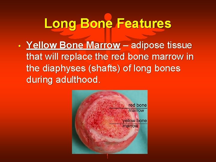 Long Bone Features • Yellow Bone Marrow – adipose tissue that will replace the