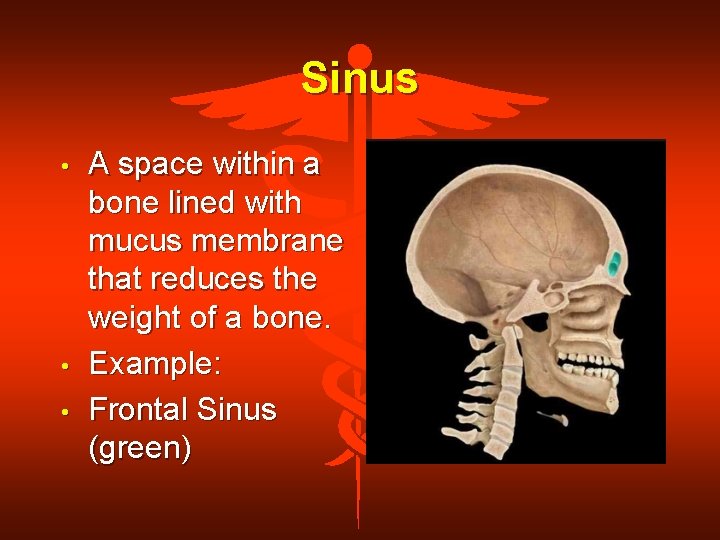 Sinus • • • A space within a bone lined with mucus membrane that