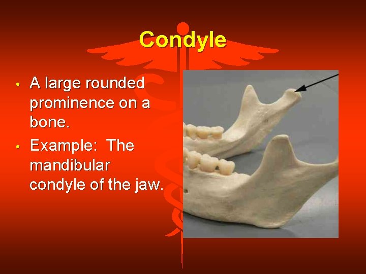 Condyle • • A large rounded prominence on a bone. Example: The mandibular condyle