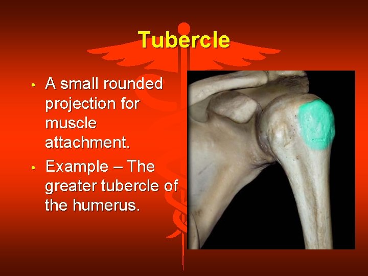 Tubercle • • A small rounded projection for muscle attachment. Example – The greater