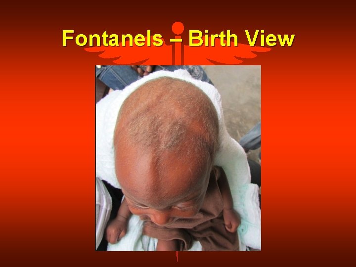 Fontanels – Birth View 