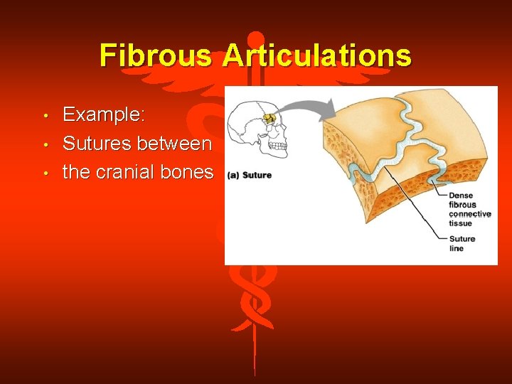 Fibrous Articulations • • • Example: Sutures between the cranial bones 