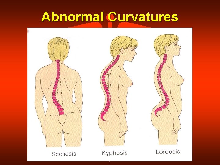Abnormal Curvatures 