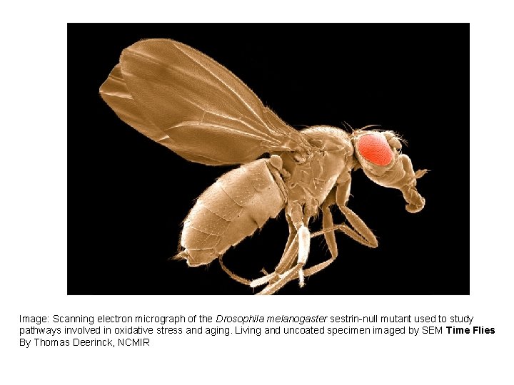 Image: Scanning electron micrograph of the Drosophila melanogaster sestrin-null mutant used to study pathways
