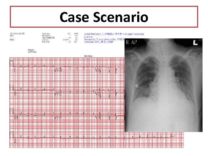 Case Scenario 