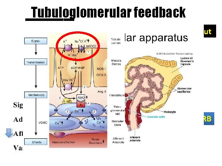 Tubuloglomerular feedback Bleeding, Dehydration Low cardiac output SGLT-2 inhibitor DM, SGLT increase ACEI /