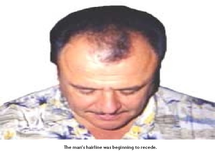 The man’s hairline was beginning to recede. 