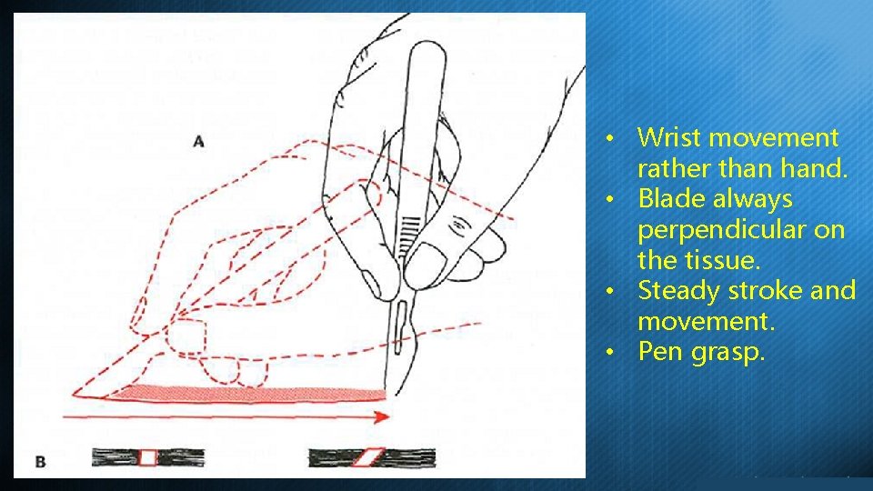  • Wrist movement rather than hand. • Blade always perpendicular on the tissue.