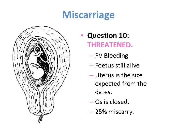 Miscarriage • Question 10: THREATENED. – PV Bleeding – Foetus still alive – Uterus