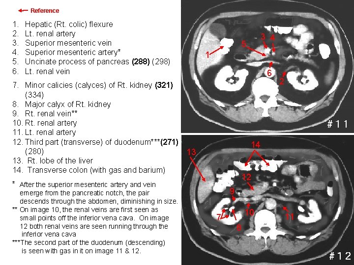 Reference 1. 2. 3. 4. 5. 6. Hepatic (Rt. colic) flexure Images 11 &