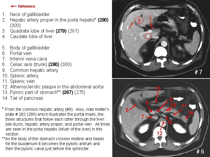 Reference Images 7 & 8 1. Neck of gallbladder 2. Hepatic artery proper in