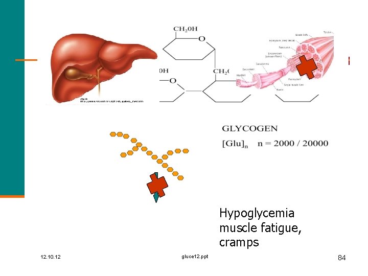 Hypoglycemia muscle fatigue, cramps 12. 10. 12 gluce 12. ppt 84 