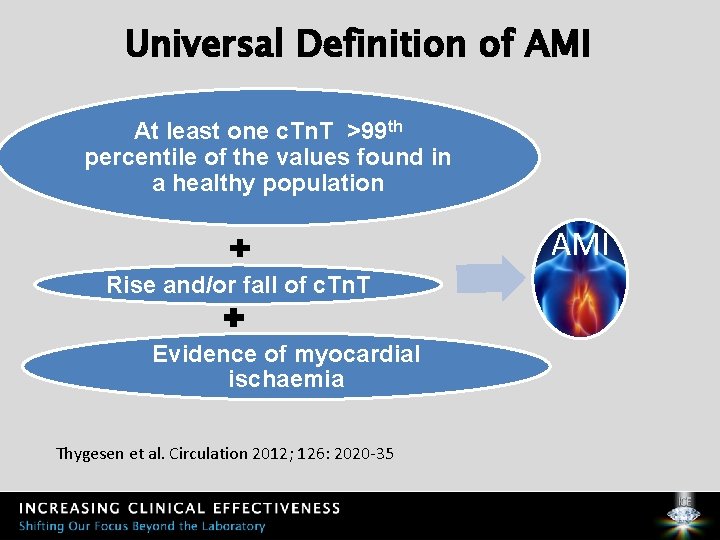 Universal Definition of AMI At least one c. Tn. T >99 th percentile of