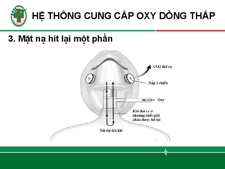 HỆ THỐNG CUNG CẤP OXY DÒNG THẤP 3. Mặt nạ hít lại một phần