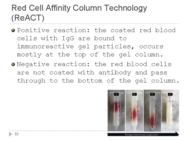 Red Cell Affinity Column Technology (Re. ACT) Positive reaction: the coated red blood cells Red Cell Affinity Column Technology (Re. ACT) Positive reaction: the coated red blood cells