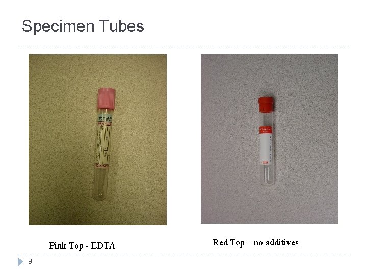 Specimen Tubes Pink Top - EDTA 9 Red Top – no additives 