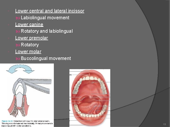  Lower central and lateral incissor Labiolingual movement Lower canine Rotatory and labiolingual Lower