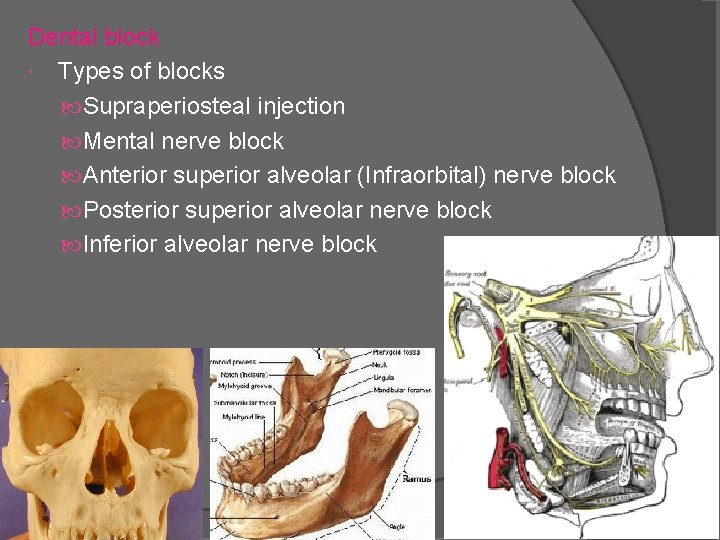Dental block Types of blocks Supraperiosteal injection Mental nerve block Anterior superior alveolar (Infraorbital)