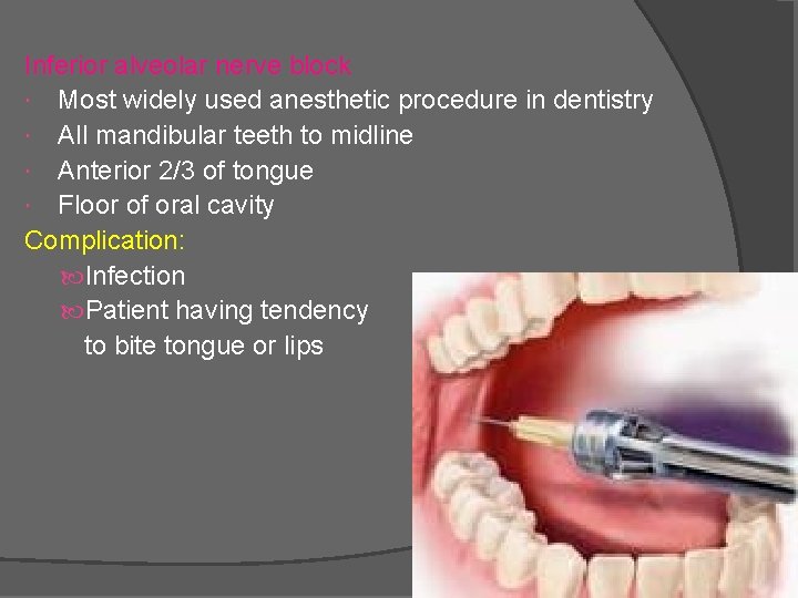 Inferior alveolar nerve block Most widely used anesthetic procedure in dentistry All mandibular teeth