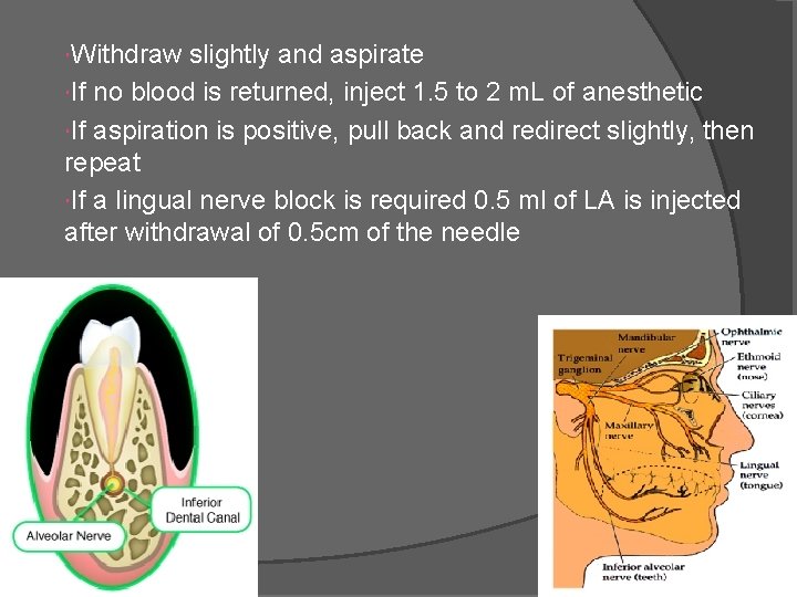  Withdraw slightly and aspirate If no blood is returned, inject 1. 5 to