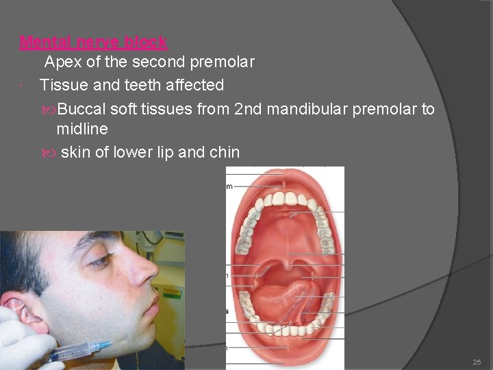 Mental nerve block Apex of the second premolar Tissue and teeth affected Buccal soft