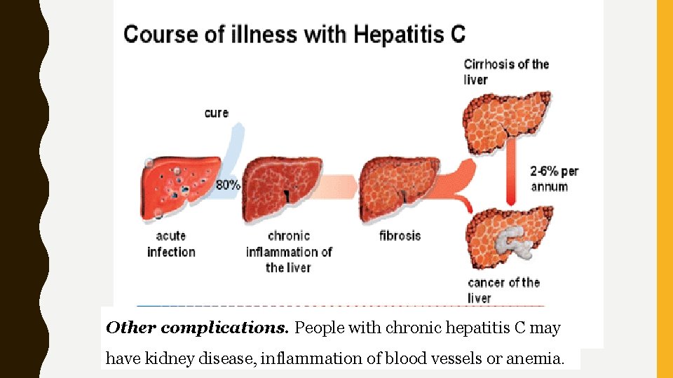 Other complications. People with chronic hepatitis C may have kidney disease, inflammation of blood