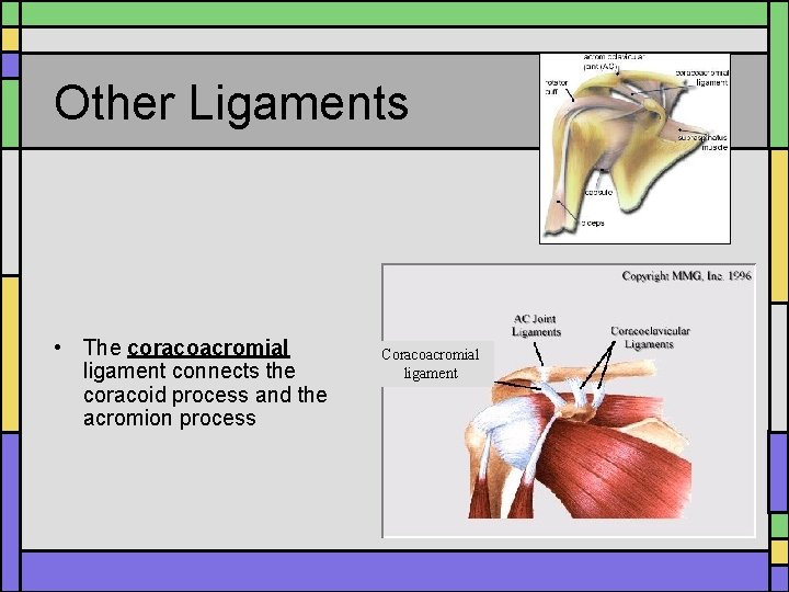 Other Ligaments • The coracoacromial ligament connects the coracoid process and the acromion process