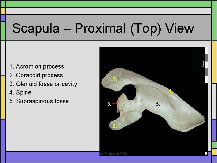 Scapula – Proximal (Top) View 1. Acromion process 2. Coracoid process 3. Glenoid fossa