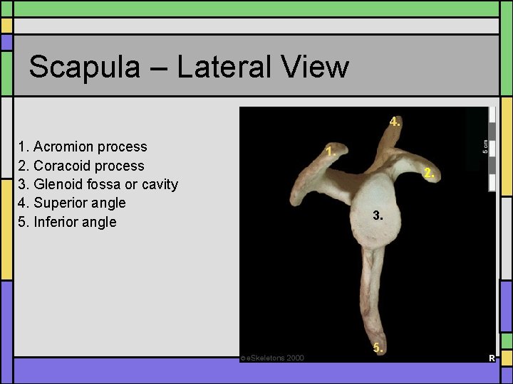 Scapula – Lateral View 4. 1. Acromion process 2. Coracoid process 3. Glenoid fossa