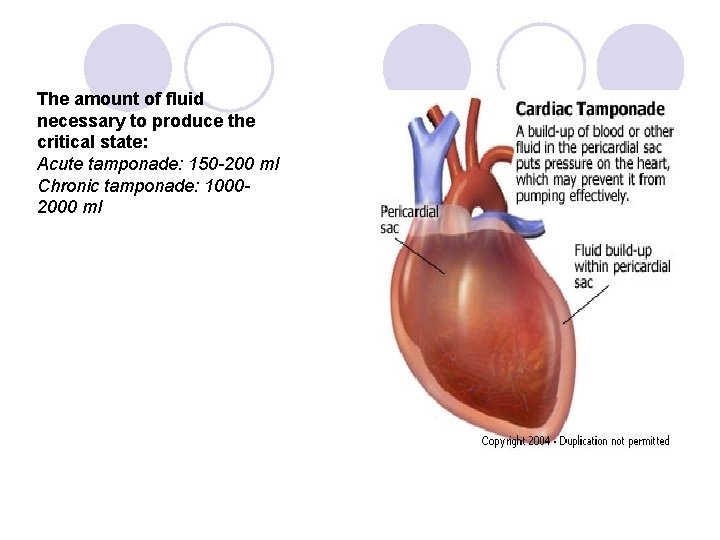 The amount of fluid necessary to produce the critical state: Acute tamponade: 150 -200