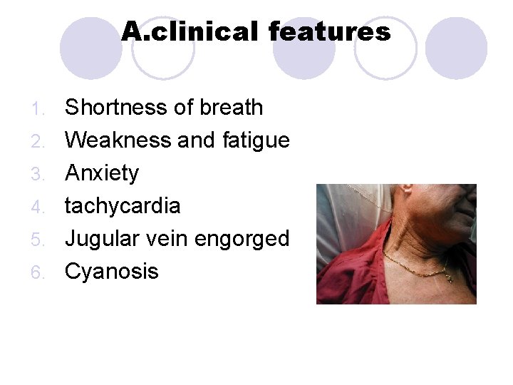 A. clinical features 1. 2. 3. 4. 5. 6. Shortness of breath Weakness and